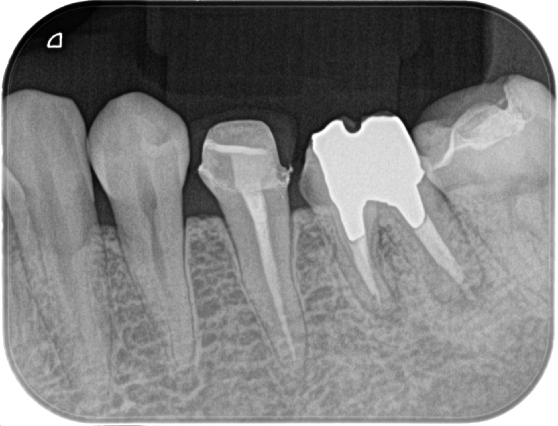 なぜ歯科治療は時間がすごくかかるのか？歯科に対して不満しかないが
