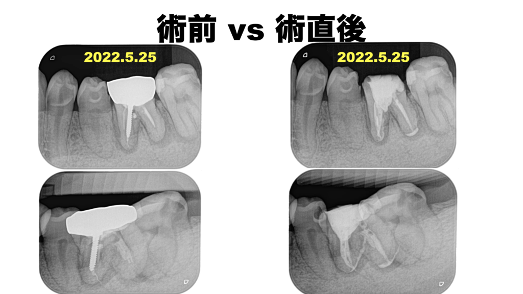 08aadb94965a793cf692c93d909d14